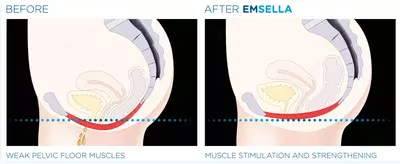 решение для женщин и мужчин!