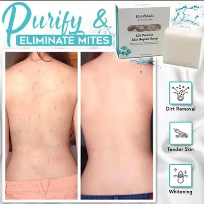 Фиброиновое мыло из козьего молока Befuman Silk Protein Skin Repair Фиброиновое мыло из козьего молока Befuman Silk Protein Skin Repair