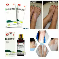 Лосьон для лечения витилиго