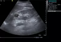 Кабинет ультразвуковой диагностики / УЗИ исследование брюшной полости и забрюшинного пространства - 300 000 сум