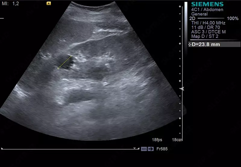 Кабинет ультразвуковой диагностики / УЗИ исследование брюшной полости и забрюшинного пространства - 300 000 сум