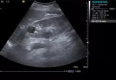 Кабинет ультразвуковой диагностики / УЗИ исследование брюшной полости и забрюшинного пространства - 300 000 сум