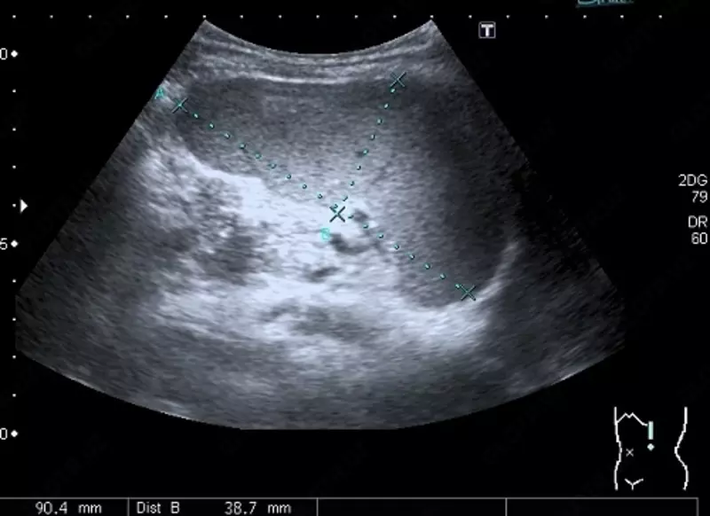 Кабинет ультразвуковой диагностики / УЗИ селезенки - 70 000 сум