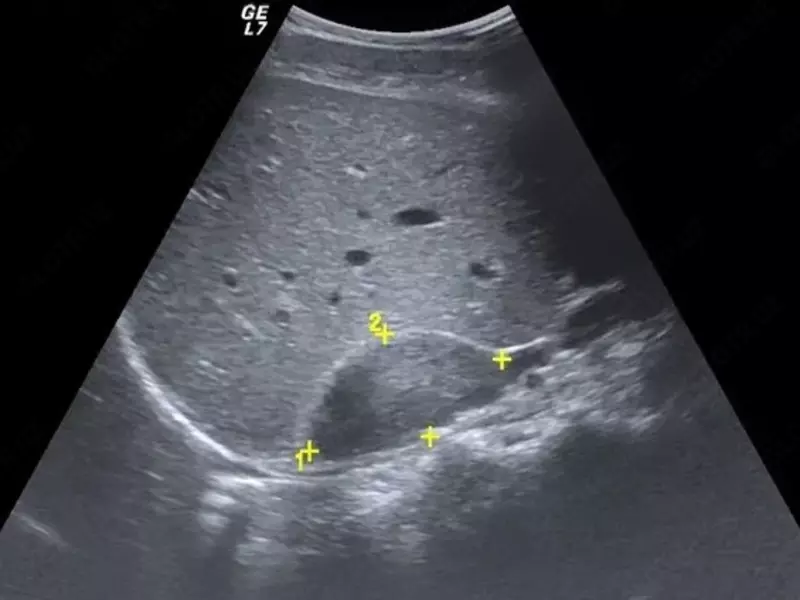 надпочечники