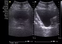 Кабинет ультразвуковой диагностики / УЗИ мочевой пузырь с определением остаточной мочи - 60 000 сум