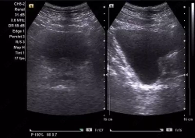 Кабинет ультразвуковой диагностики / УЗИ мочевой пузырь с определением остаточной мочи - 60 000 сум