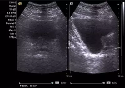 Кабинет ультразвуковой диагностики / УЗИ мочевой пузырь с определением остаточной мочи - 60 000 сум