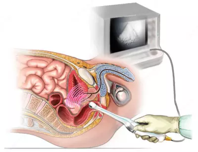 Кабинет ультразвуковой диагностики / УЗИ простаты - 55 000 сум