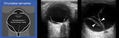 Кабинет ультразвуковой диагностики / УЗИ офтальмосканирование - 195 000 сум