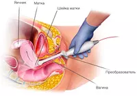 Кабинет ультразвуковой диагностики / УЗИ малый таз (вагинальное исследование)