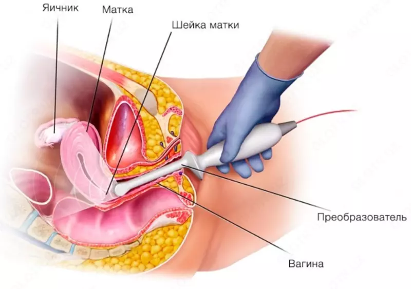 Кабинет ультразвуковой диагностики / УЗИ малый таз (вагинальное исследование) - 130 000 сум