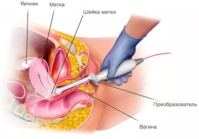 Кабинет ультразвуковой диагностики / УЗИ малый таз (вагинальное исследование) - 130 000 сум