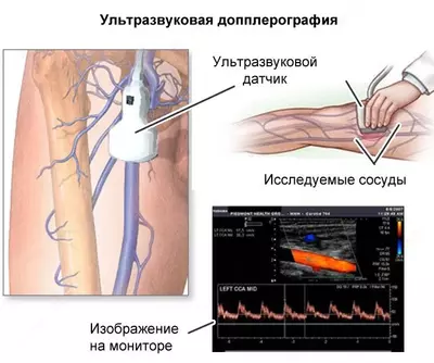 Кабинет ультразвуковой диагностики / УЗИ допплерография вен. Нижней конечности
