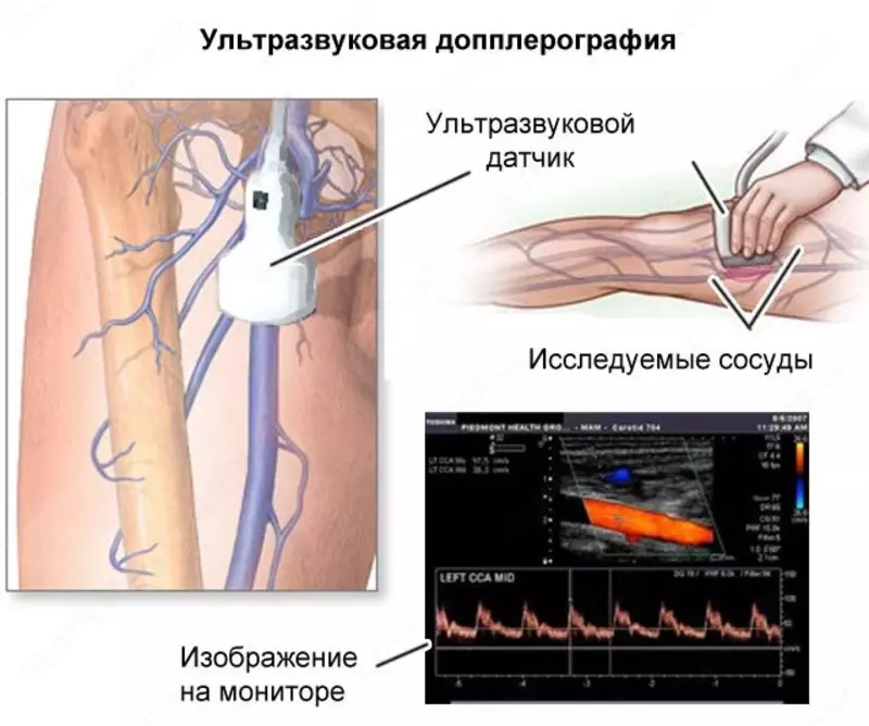 Кабинет ультразвуковой диагностики / УЗИ допплерография вен. Нижней конечности