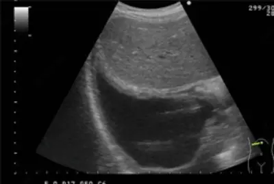 Кабинет ультразвуковой диагностики / УЗИ плевральных полостей - 95 000 сум