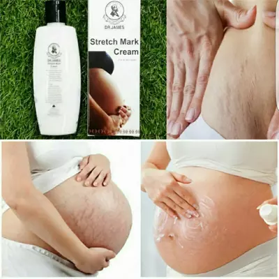 Крем от растяжек Доктор Джеймс Dr. James Stretch Mark Cream (200 мл) Только в розницу
