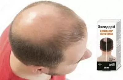 150 000 сум / шт. Спрей для роста волос ЭКСИДЕРМ