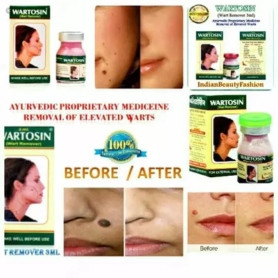 60 000 сум / шт. Гель от папиллом Wartosin