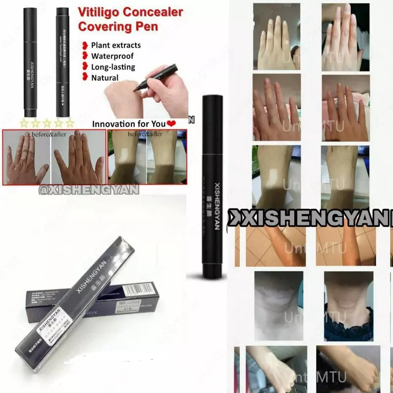 Маскировочный фломастер XISHENGYAN при витилиго - 99 000 сум