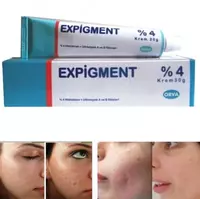 Oqartiruvchi krem ​​EXPIGMENT 4% 30 gr. - 99 000 so'm