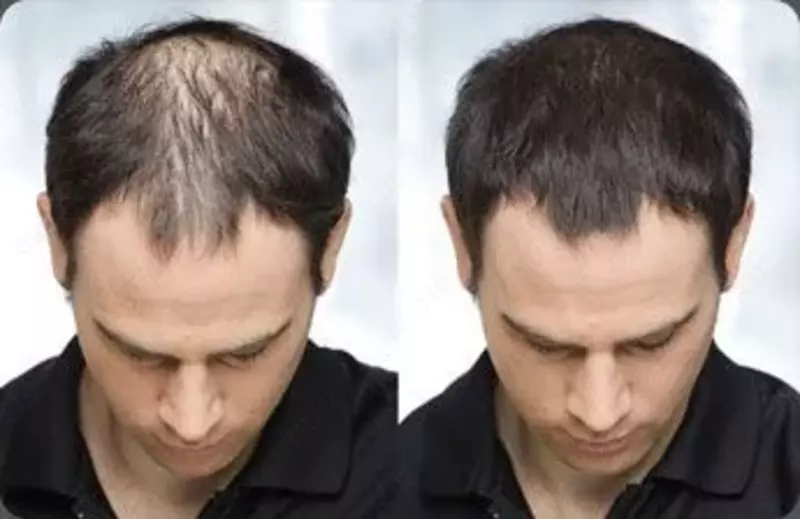 Toppik sochni qalinlashtiruvchi kukun Chakana savdo