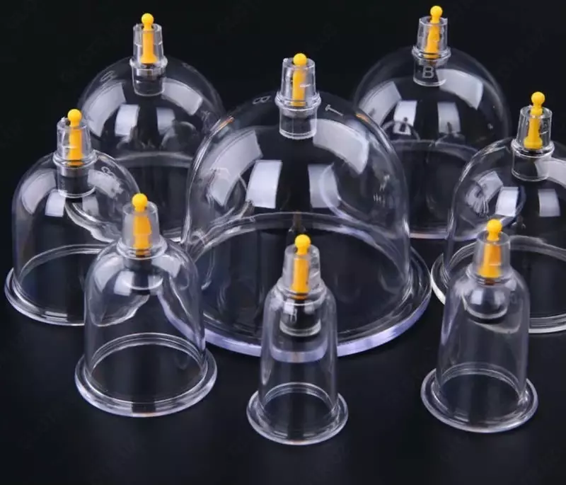 Набор банок для Хиджамы (кровопускания)