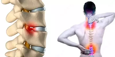 Лечебный массаж  кундалини