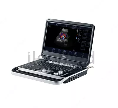 Портативная ультразвуковая диагностическая система Finus 50 с цветным доплером