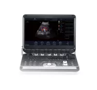   Портативная ультразвуковая диагностическая система Finus 50 с цветным доплером