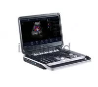  Портативная ультразвуковая диагностическая система Finus 50 с цветным доплером OOO «ILENMED»