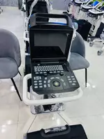 Система Ультразвуковая Диагностическая Модель: Zoncare-M5 - в рассрочку от 501 сум