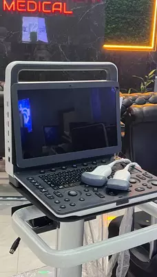 Система Ультразвуковая Диагностическая Модель: Zoncare-M30 - 166 902 052.8 сум / шт.