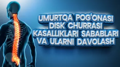 250 000 сум ЛФК/Кинезитерапия