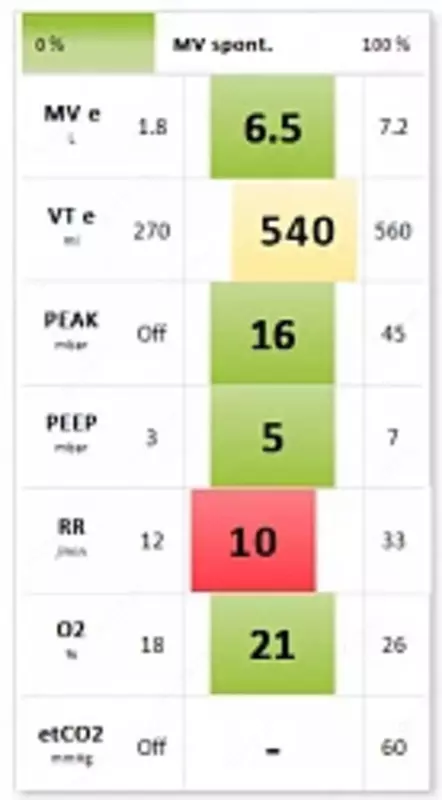 775 000 000 сум ELISA 600 Аппарат ИВЛ