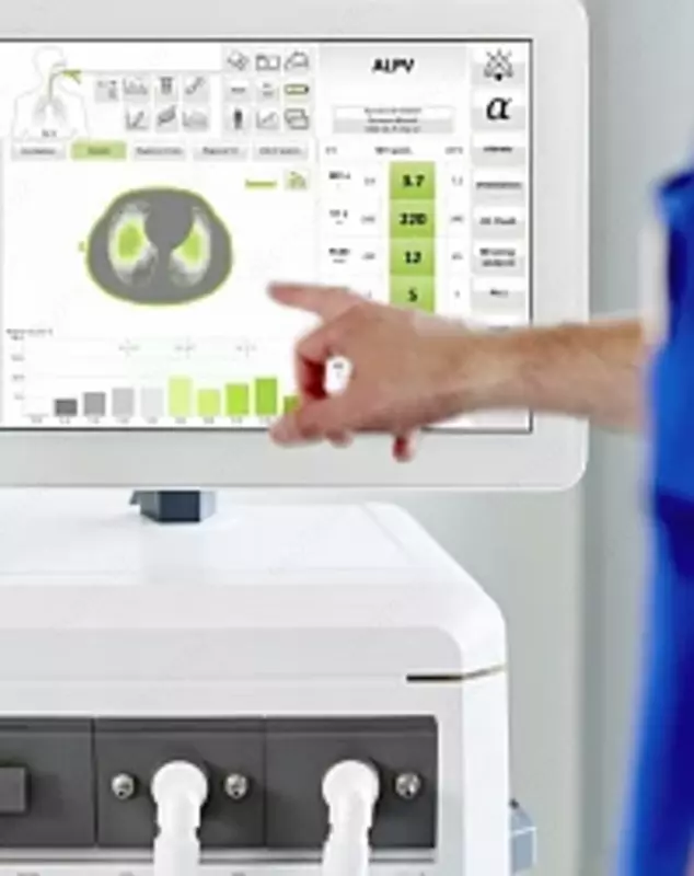 780 000 000 so'm ELISA 800 — Sun’iy nafas olish apparati (IVL apparati)