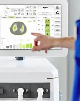 780 000 000 so'm / dona ELISA 800 — Sun’iy nafas olish apparati (IVL apparati)