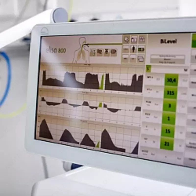 ELISA 800 — Sun’iy nafas olish apparati (IVL apparati) Chakana savdo