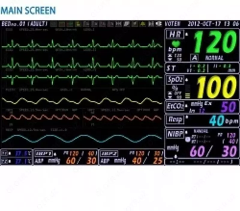 VP 700 Прикроватный монитор Только в розницу