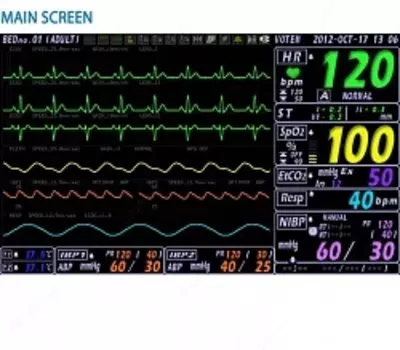 VP 700 – Yotoq yonidagi monitor Chakana savdo
