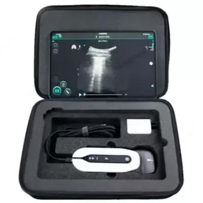 Sonoeye ultratovush diagnostika tizimi