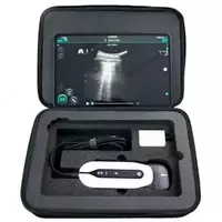 Sonoeye ultratovush diagnostika tizimi