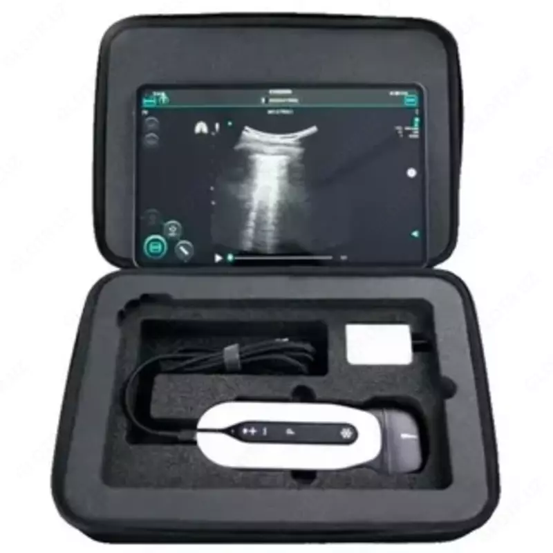Sonoeye ultratovush diagnostika tizimi
