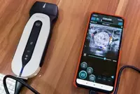  Sonoeye ultratovush diagnostika tizimi - 