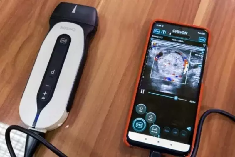  Sonoeye ultratovush diagnostika tizimi - 