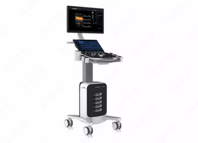 XBit 80 C rangli dopplerli ultratovushli diagnostika tizimi
