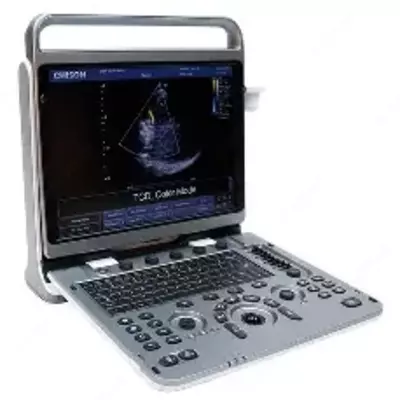  Chison Ebit50 ultratovush apparati - 