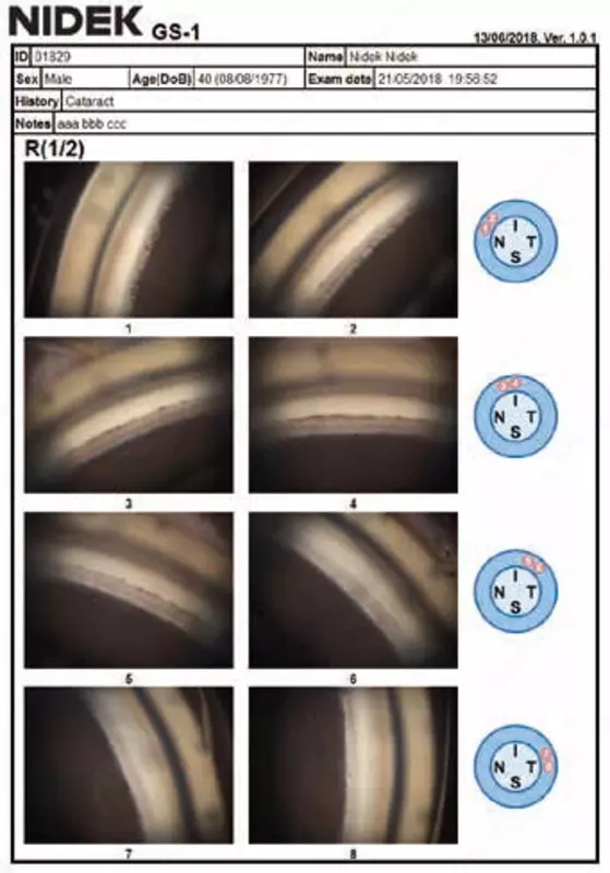 по запросу NIDEK GS-1 Автоматизированный гониоскоп