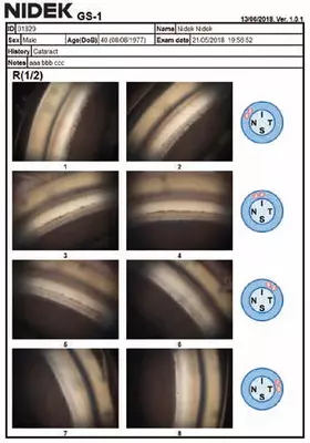Цена по запросу NIDEK GS-1 Автоматизированный гониоскоп