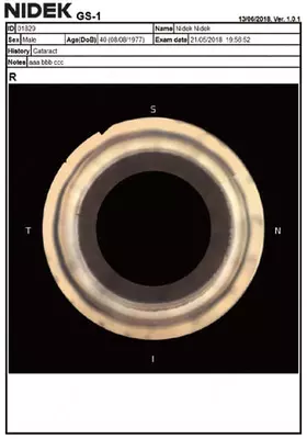 NIDEK GS-1 Автоматизированный гониоскоп Оптом и розница