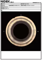 NIDEK GS-1 Автоматизированный гониоскоп Оптом и розница